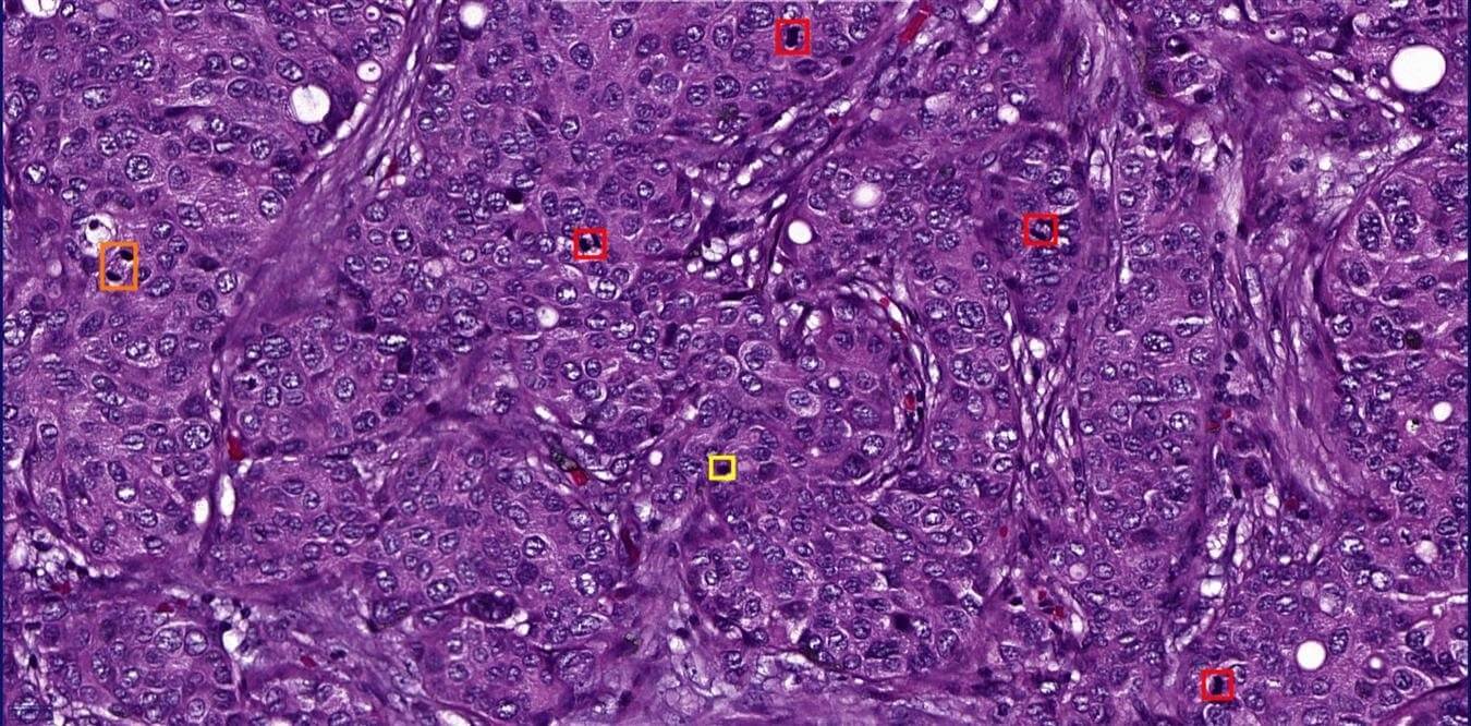 Mitosis Detection