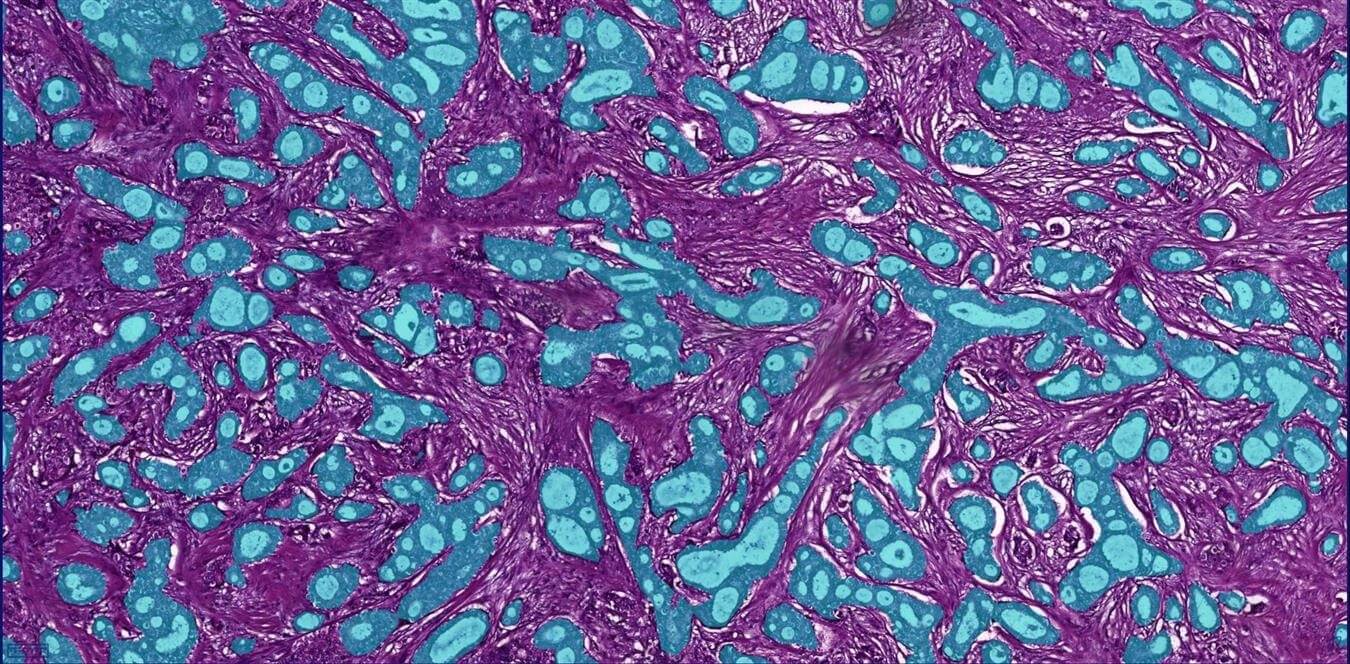 Tubule Detection